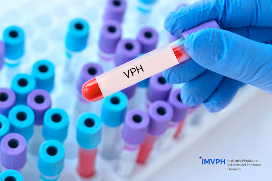 Existen pruebas para detectar el VPH en tu cuerpo.